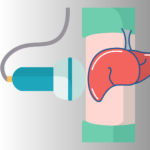 Hepatologischer Frühling 2023